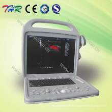 Tragbarer Farbdoppler-Ultraschallscanner (THR-CD580)